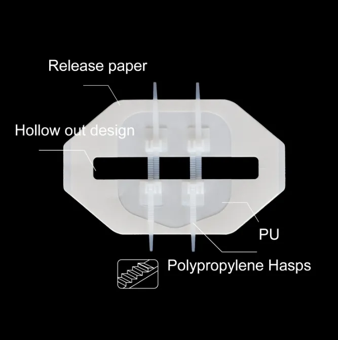 Zip Wound Strip